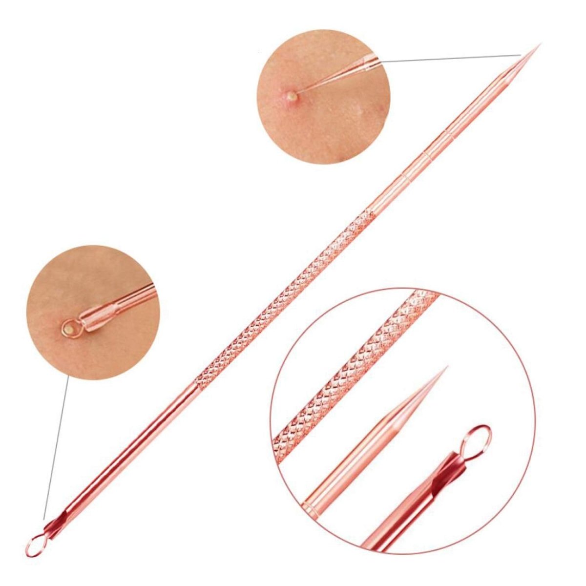 Blackhead & Pimple Removal Kit – Comedone Extractor Tool Set, Blackhead Remover Tools with Travel Case