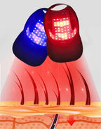 Red Light Cap – LED Red & Infrared Light Hair Cap for Scalp Care, Cordless At-Home Use – HairGlow Pro